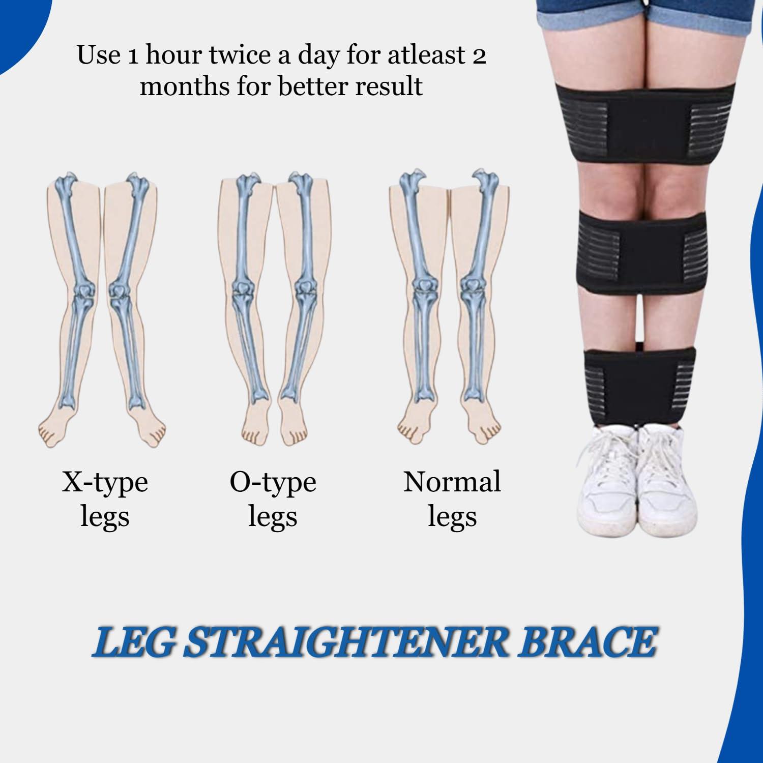 Lexotho Lexotho bow leg correction belt for men o/x type women leg corrector o/x type leg correction support strap brace bandage Correction Brace Belt (Large)