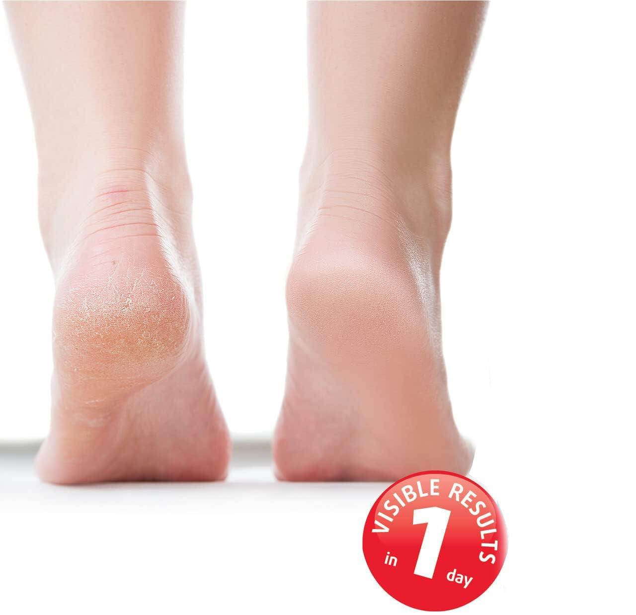 Jas Raney Foot Magic Moisturizing Foot Cream for Dry, Cracked Heels, Feet Moisturizer with Fragrance 100ml