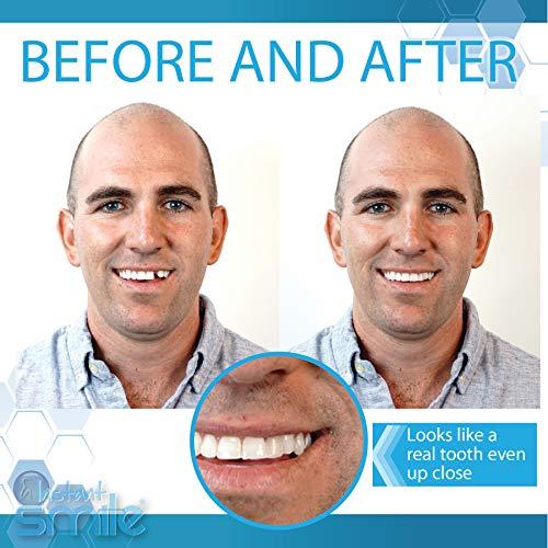 Instant Smile Instant Smile Complete Your Smile Temporary Tooth Replacment Kit - Replace a missing tooth in minutes