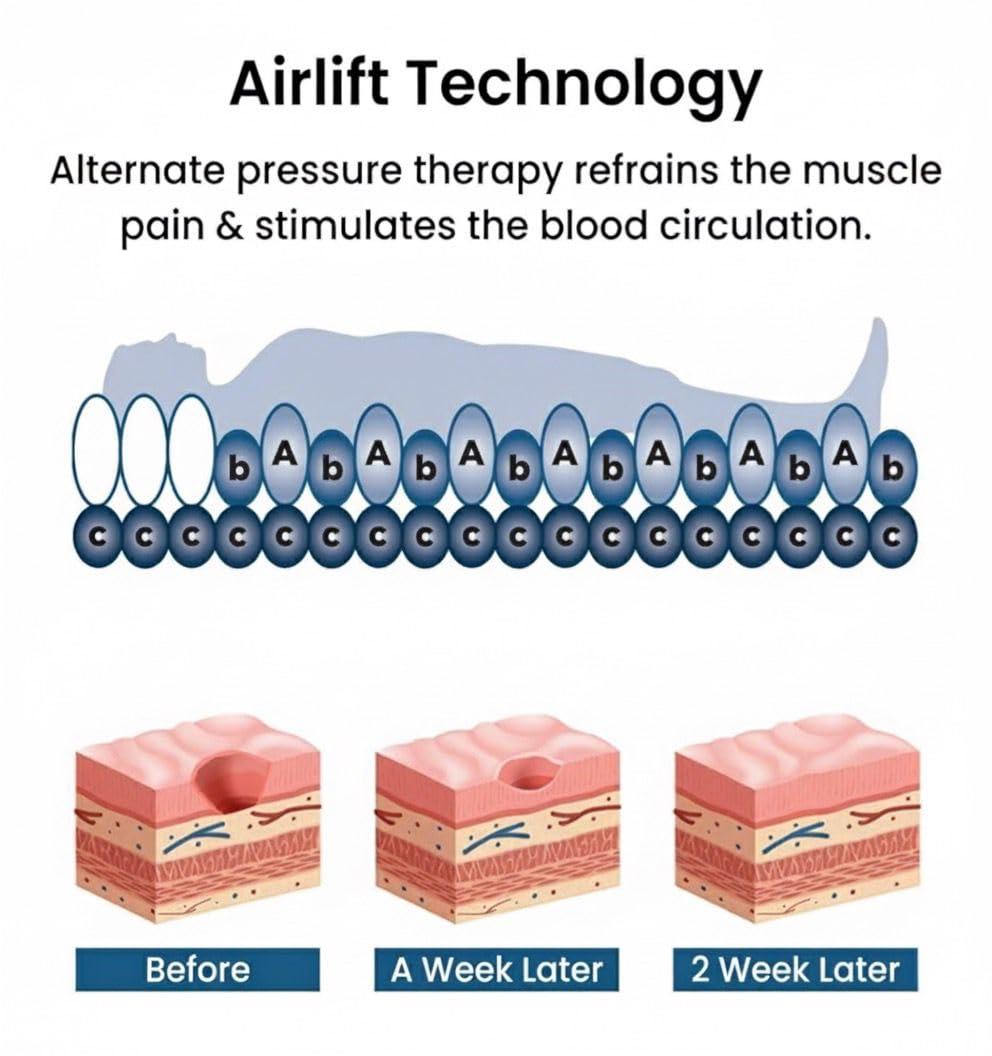 caresome caresome Air Mattress Anti Decubitus Air Pump and Bubble Mattress: Advanced Bed Sore Prevention for Bedridden Patients, Men & Women