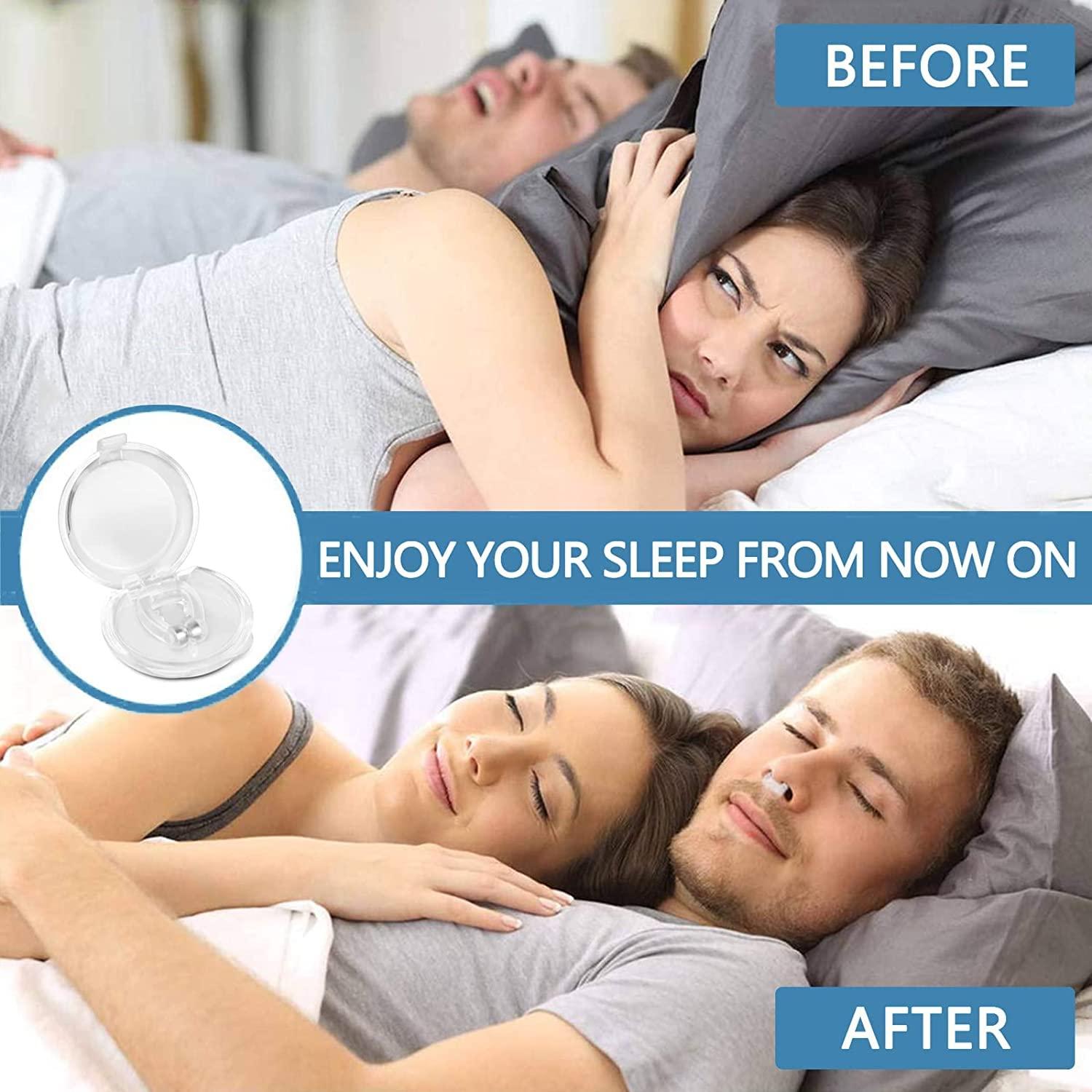 Laxit Laxit Anti Snoring Device, Snore Free Nose Clip, Snoring Solution, Relieve Snore, Sleeping Aid Devices for Ease Breathing, Silicone Magnetic Nose Clip For Men Women Relieves Nasal Better Breath (1)
