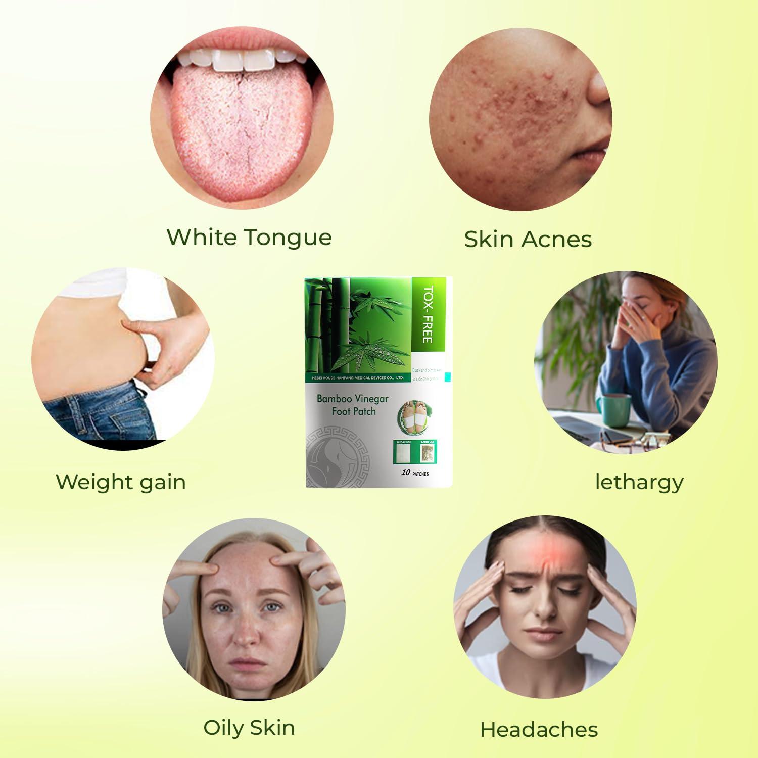 ABELIA Abelia TOX-FREE Detox Foot Patches Pain-Free Pads for Stress Relief Sleep, Natural Ingredients for Adhesive Foot Cleansing Detoxing Patch and Body Cleansing (Set of 1, 10 Patches)