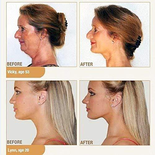 Portible Portible Neck Slimmer Double Chin Remover Reducer | Face Lift Neck Massager Neck Genie Elite Neckline Slimmer | Facial Flex Fitness Jawline Exerciser Shaper (Pack Of 1).