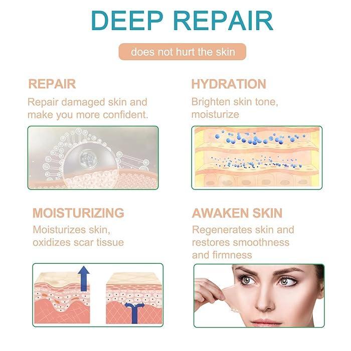 Kwinto Silicone Scar Sheets, Silicon gel sheets for Scars Transparent Medical Silicone Gel Tape for Scar Removal, Silicone Scar Tape Roll For Hypertrophic Scars and Keloids Caused by Surgery