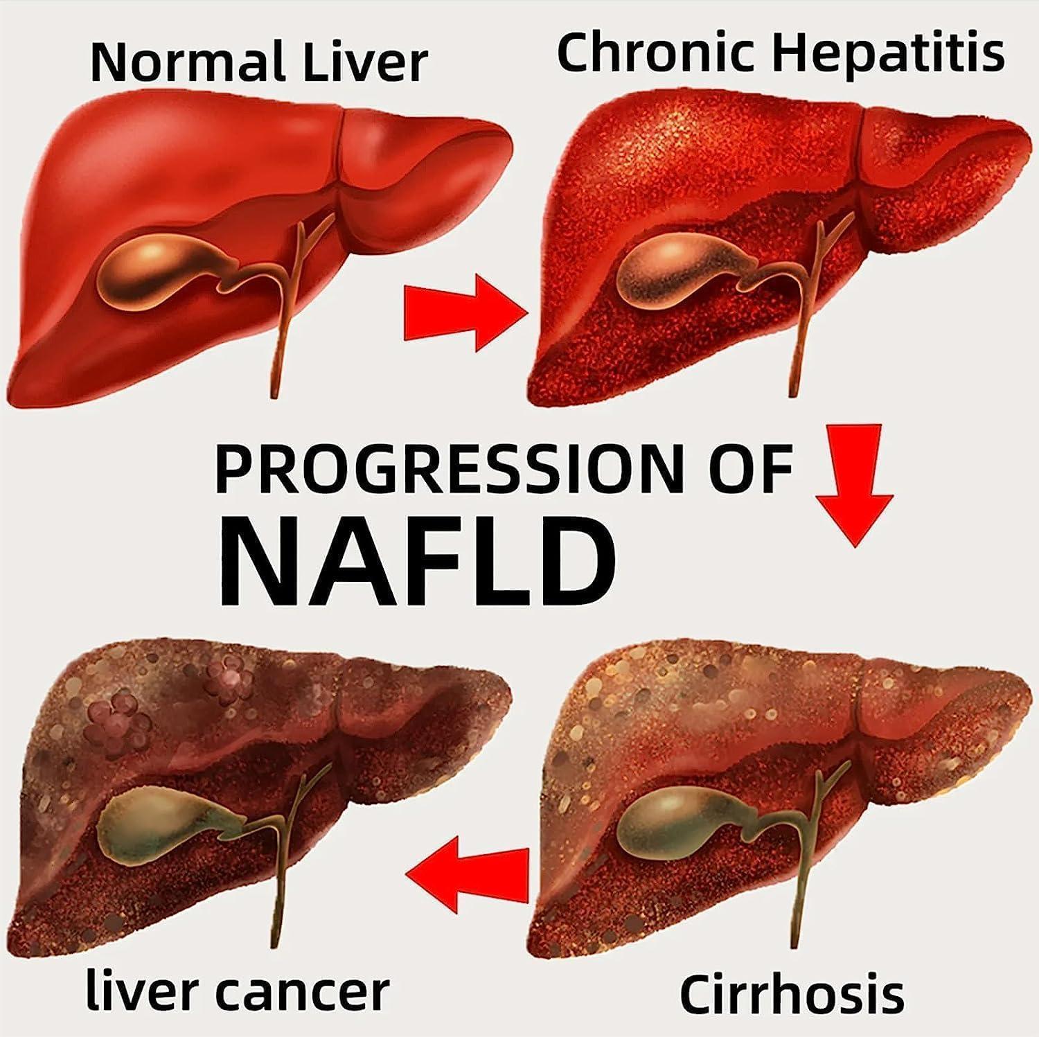 3nh 3NH Milk Thistle & Cordyceps Sinensis Drops,Milk Thistle & Cordyceps Extract Herbal Drop,Cordyceps Sinensis Drops, Powerful Liver Support (2PCS)