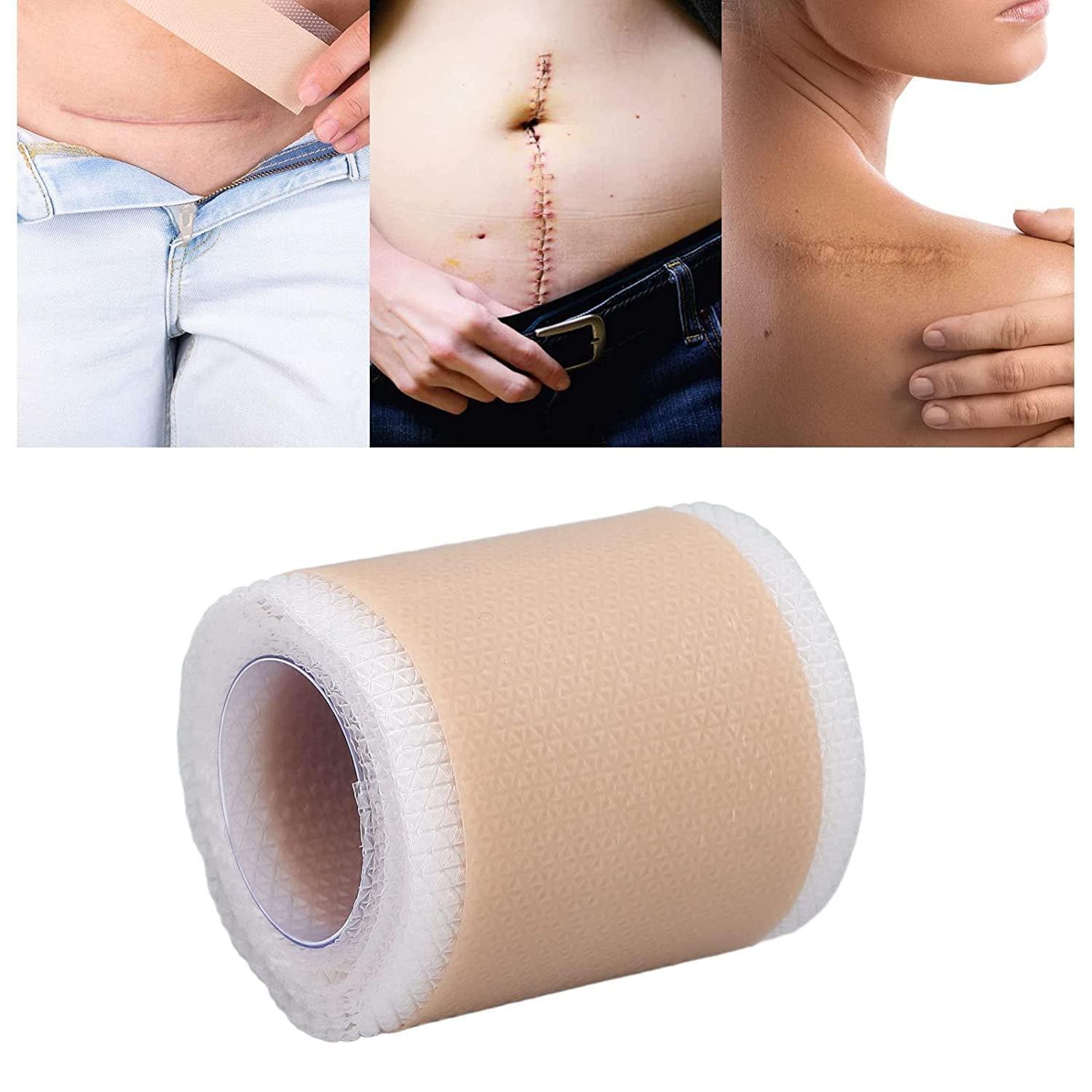 ZUMIE ZUMIE Silicon for Scars Recovery Medical Silicone for Scar Removal, Transparent Tear Silicone Tape Roll, For Hypertrophic Scars and Keloids Caused by Surgery (Scar repair tape 1 Roll)