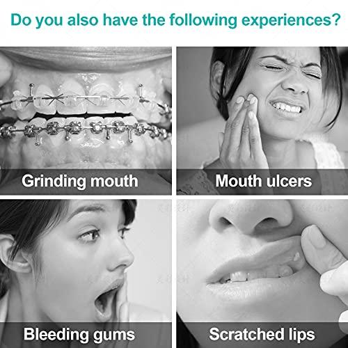 Annhua Annhua Orthodontist Wax Brace Wax Flavored 10 Pack, Dental Ortho Dots Wax Strips for Aligners, Braces Wearer, Brackets, Invisible-lingers, 10 Fruit Smell