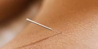 ACUPRO HEALTH CARE SYSTEM ACUPRO HEALTH CARE SYSTEM _Acs acupuncture needle sujok needle dry needling for physio therapy combo set of size Acs (25x0.13mm, 25x0.25mm) 200 needles total 2 Box