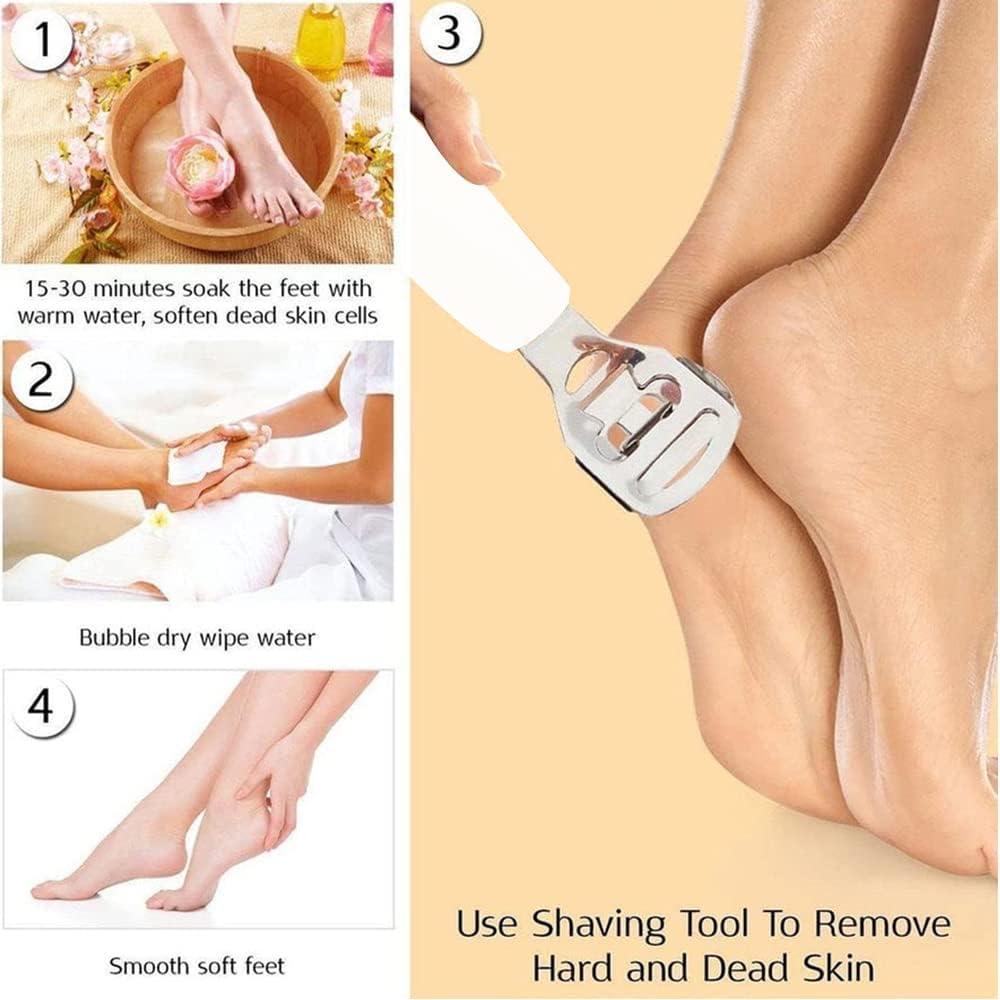 KIRA KIRA Foot Callus Shaver for Pedicure, Dead Skin Remover, Corn Cutter for Removing Solid And Cracked Skin, Heel Razor with Handle (BLUE)