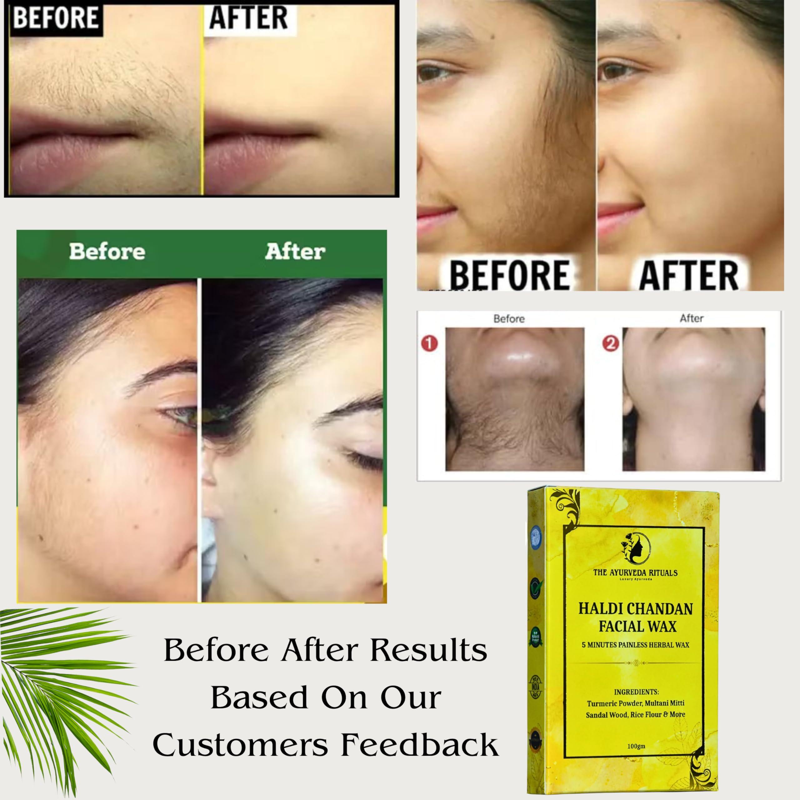 The Ayurveda Rituals The Ayurveda Rituals- Turmeric Hair Removal Wax Powder - 5 Minutes Painless Natural Herbal Facial Hair Removal Wax Powder For Women | Organic Waxing Hair Remover Powder, No chemicals - No Irritation, No Skin rashes for Women & Girls - 100g