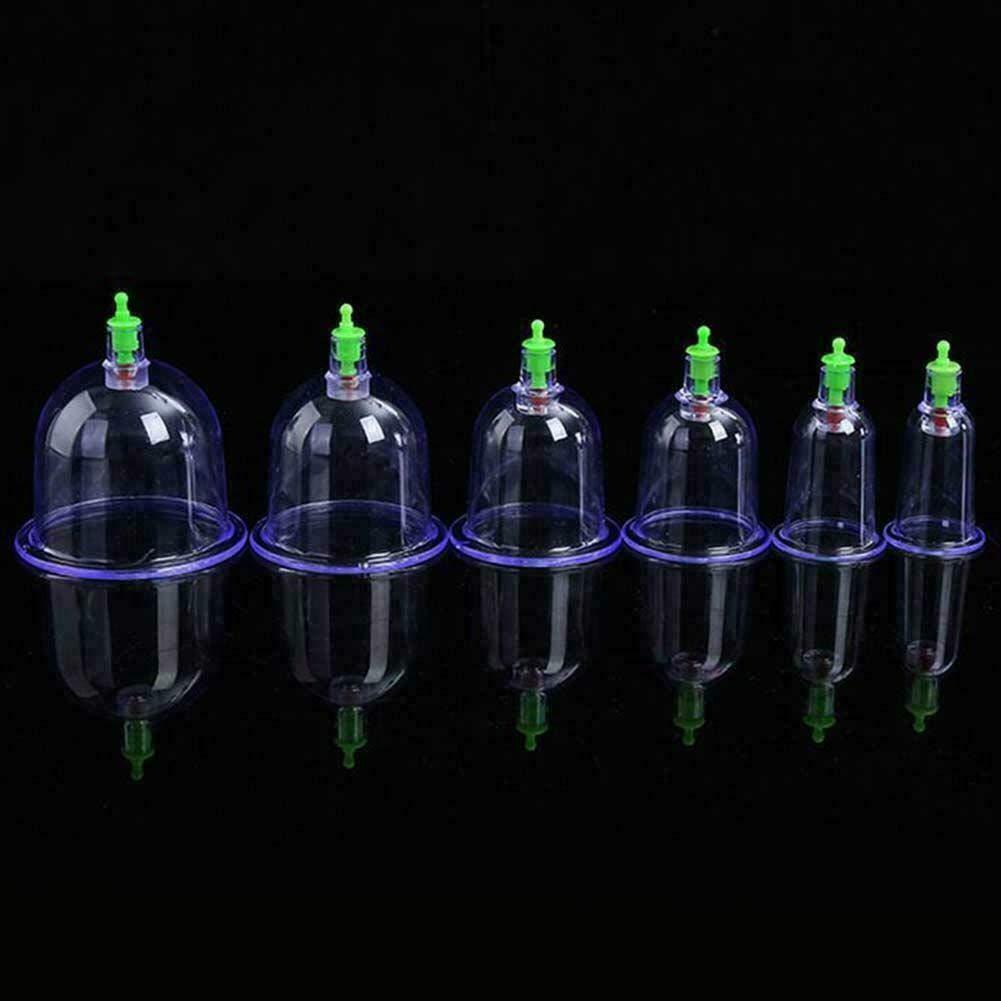 Sampton Sampton Hijama Cupping Set With Pump Vaccum Cupping Set For Pain Relief And Reduce Blood Fat Chinese Cupping Set 6 Cup Vaccum Apparatus