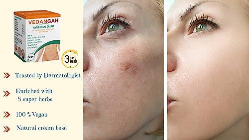 VEDANGAH VEDANGAH Anti Fungal Cream | Anti-Itching Skin Cream | Eczema | Psoriasis | Ringworm Cream 12Gm Pack Of 2