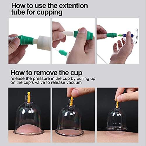 EKIN EKIN Vacuum Massage Cupping Device Cupping hijama Therapy Machine Cupping Massage pump (Black)