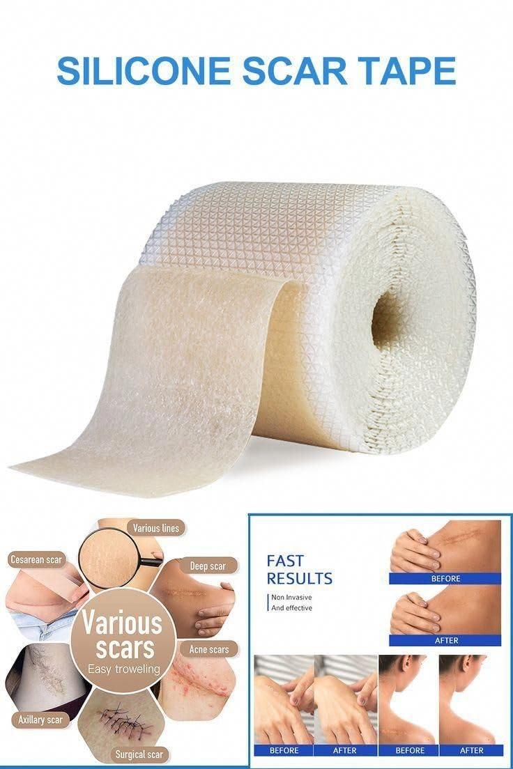 Dr. Navadiya Soft, Washable Silicone Scar Sheets - Painless Scar Removal for Surgery, C-section, Burn Etc. - Suitable for All - 1 Roll (150 Cms)