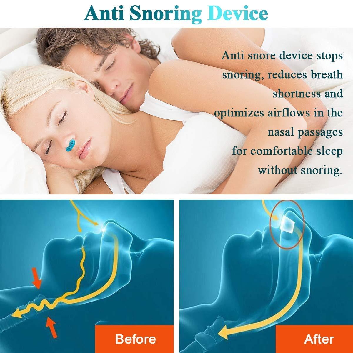 APURK APURK 2 in 1 Nose clip Snoring Solution Snore Stopper Nose Vents Plugs Clip Air Purifier,Anti Snoring Devices Stop Snoring Sleep Aid Nasal Dilator Snore Reducing Aids for Men Women