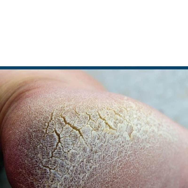 vinarghya vinarghya Aamsul Tail/Kokum Oil/Kokamba/Kokam/Bheranda/Murgal/Kaattampi/Murgina/Punaruli/Devana Huli/Tintali / 100g