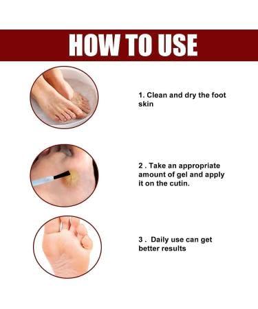AB Company BINGEABLE Ease Foot Corn & Callus Removal Gel | Fast Relief for Hard Skin | Foot Care Treatment | (60ML)