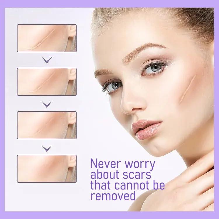 Bioline Bioline Clear Silicon Scar Sheet 4 x 150 Cm for Healing Scars Transparent tear silicone tape roll for hypertrophic scars and keloids caused by surgery, medical silicone for scar removal