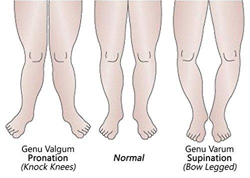 Laminet Cover Co. Posture Corrective Heel Cups W8.5-11/M7-13