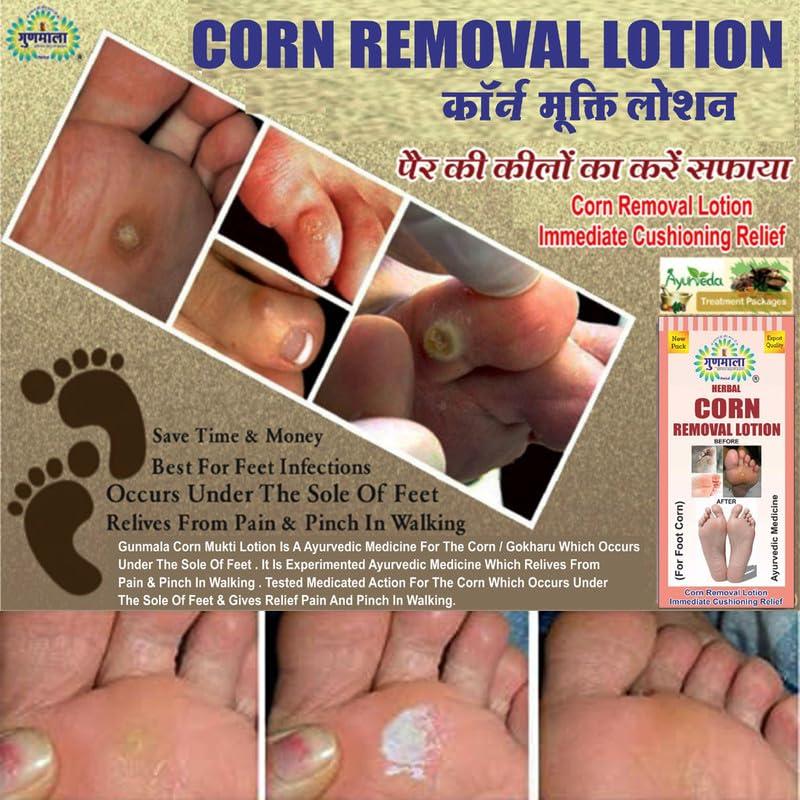 Gunmala Herbals Gunmala Herbals Corn Removal Lotion-Fast Acting Liquid Callus Remover,For Safe Removes Foot Or Hand Corns&Feet Calluses Fast With Cushions,5 Ml. Bottel Pack,Qty.- Pack Of 6