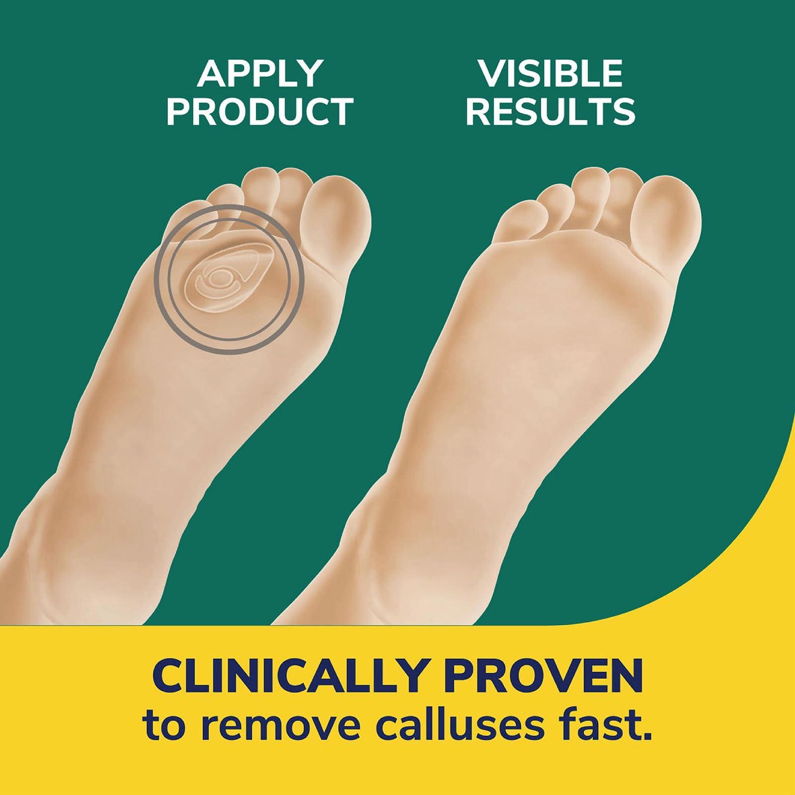 Dr. Scholl's Dr. Scholl\'s Callus Remover with Advanced Duragel Technology, 4-Pack