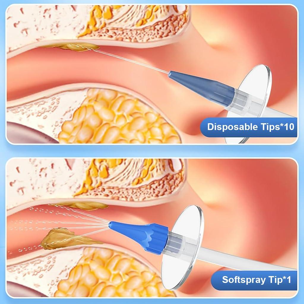 HANNEA HANNEA Manual Ear Irrigator Ear Wax Cleaner Long Pipe Ear Wax Removal Ear Canal Irrigator for Adults & Kids Ear Cleaning Rinser with 10Pcs Single Hole Nozzles, 1 Five Hole Nozzle, 250ml Water Cup