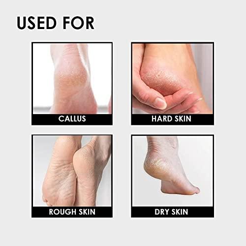 Tandem Tandem Sponge Foot File Buffer Pad Callus Remover for Feet, Heel Scrub Pedicure File Stone Exfoliator Tools for Dead Skin Removal (Assorted) (Pack Of 1)