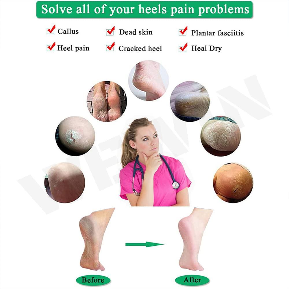 UBERSWEET Ubersweet Invisible Height Increase, Concealed Footbed Enhancer, Insoles Pad Breathable Odour-Free Wearable Silicone Height Increase Socks Heel Lift Gel, Unisex (3CM_Beige Color)\'||