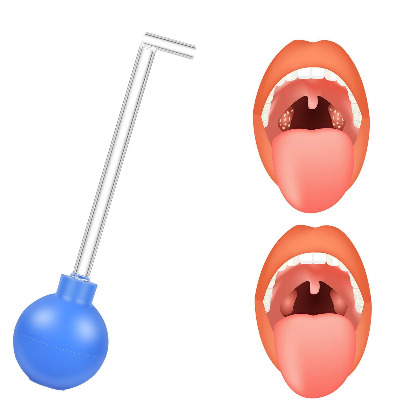 TOTOKA Tonsil Stone Remover Vacuum Kit Manual Style Cleaner Removal Tonsil stone remover vacuum Suitable for Oral Cleaning Oral Care Blue 1Pcs