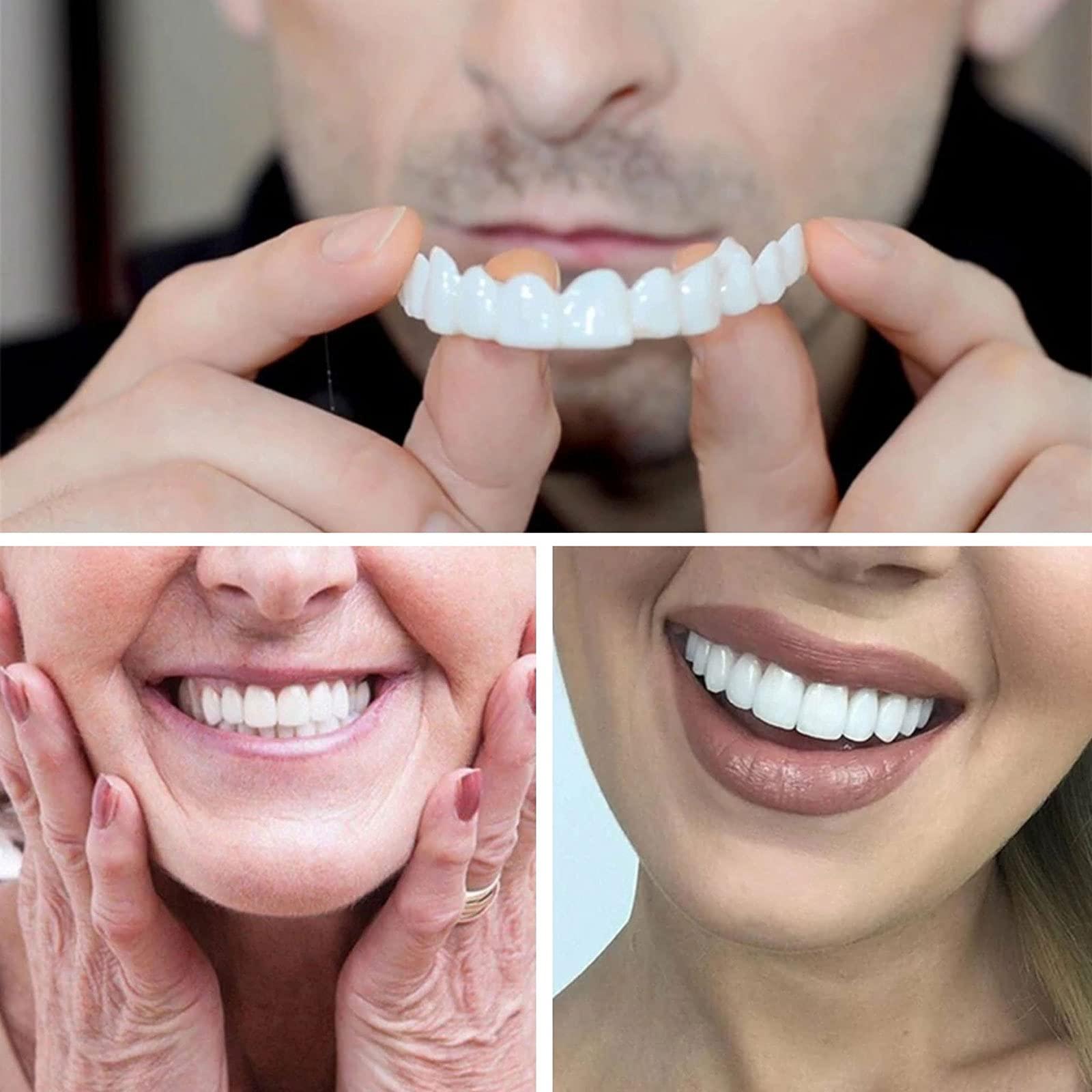 icehao Teeth Brace Cover Instant Smile Teeth Veneers Beautiful Smile Dentures Veneers Fake, Veneers Dentures Socket for Women and Men, Dental Veneers for Temporary Tooth 2pcs Repair