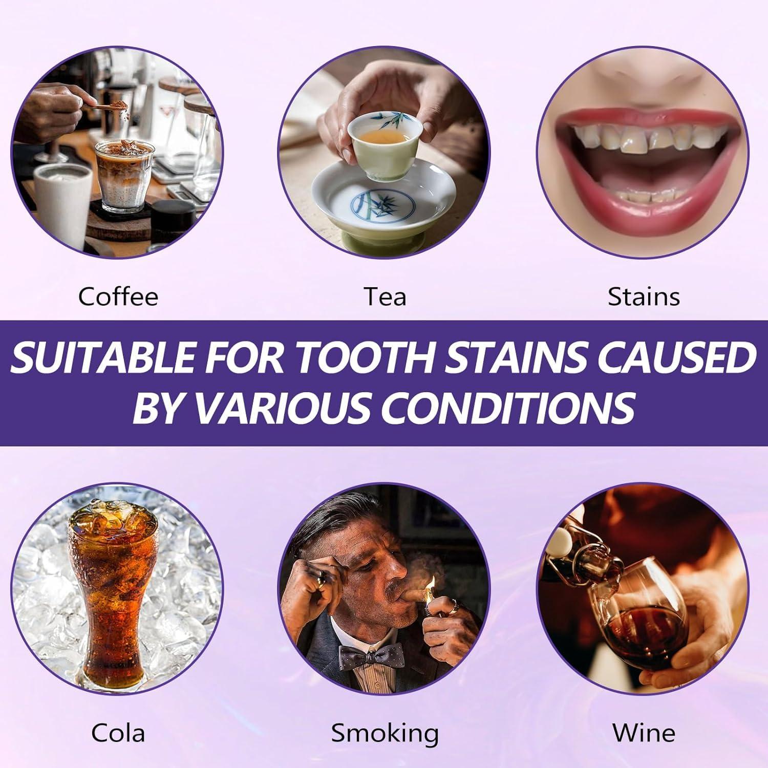 P S ASSOCIATES P S ASSOCIATES Purple Toothpaste for Teeth Whitening, Purple Toothpaste, Colour Corrector, Teeth Whitening Brightening, Purple Whitening Toothpaste - Enamel-Friendly Formula for a Dazzling Smile (30ML)