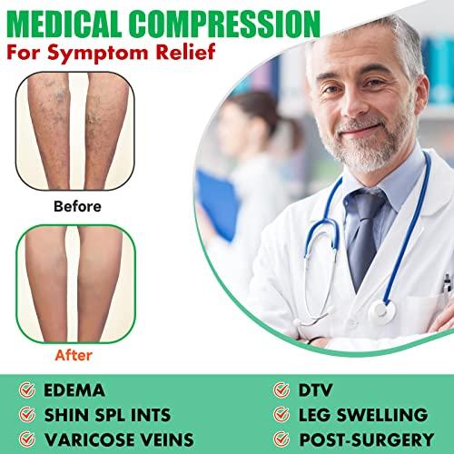 MGANG Compression Socks, Open Toe, 15-20 mmHg Graduated Compression Stockings for Men Women, Knee High Compression Sleeves for DVT, Maternity, Pregnancy, Varicose Veins, Relief Shin Splints, Beige XXL