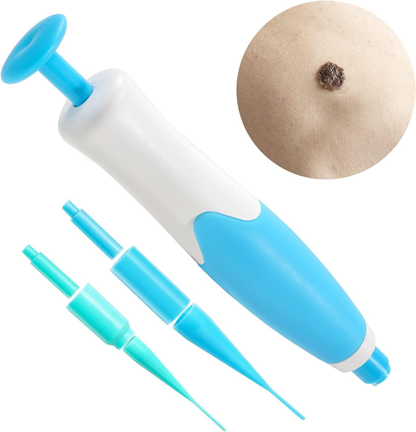 ISTARA Istara Painless Skin Tag Remover Kit 2 in 1 Skin Tag Removal with Auto Skin Tag Remover Pen with 20 Micro and 20 Regular Skin Tag Bands, Safe and Painless Remove 2mm - 8mm Skin Tags (1Pcs)