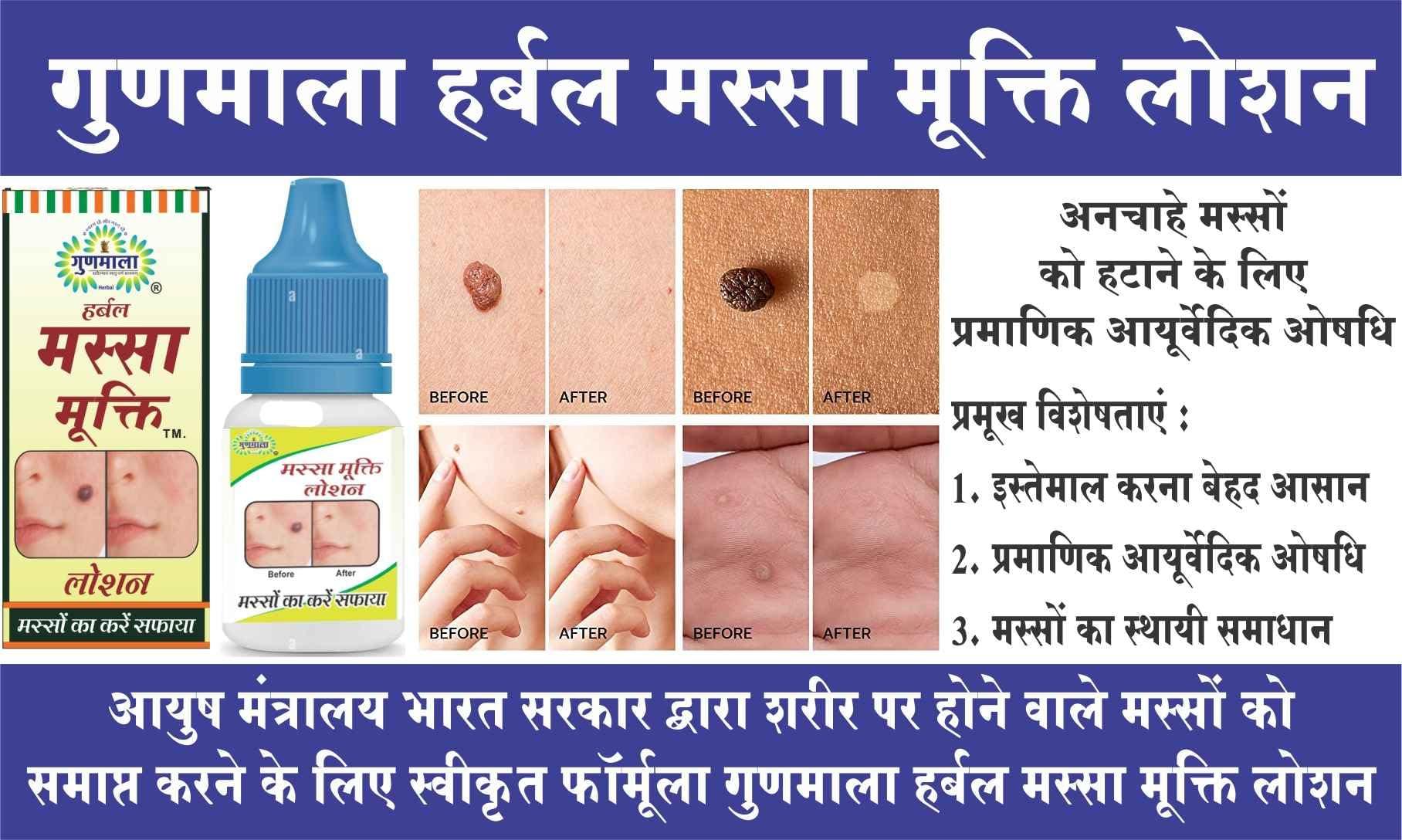 Gunmala Herbals Gunmala Herbal Massa Mukti Lotion - 20 Ml. (Ayurvedic Skin Tag Remover)