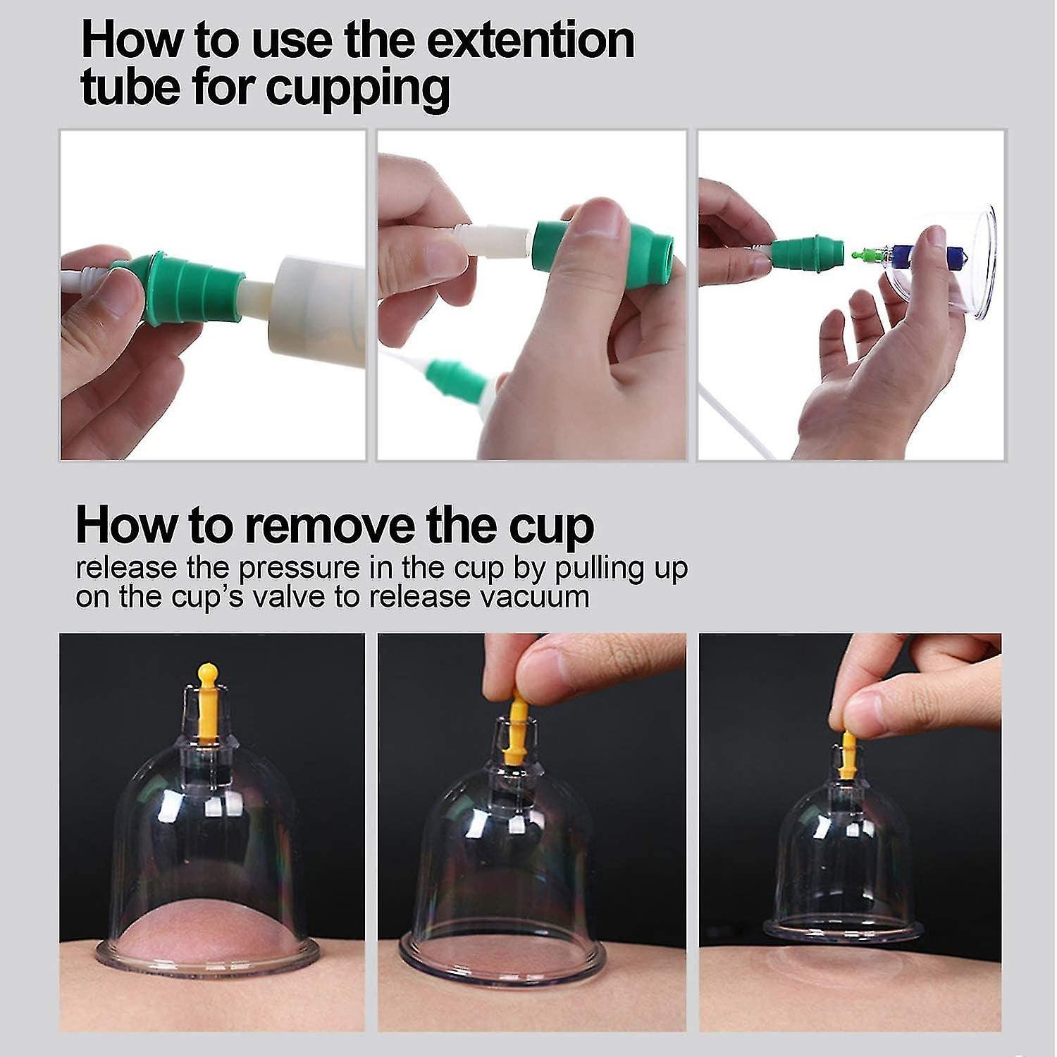 ANCS ANCS Acupressure 24 Vacuum Cups Chinese Medicine Magnet Therapy Cupping Set Acupuncture Manual Massager for Pain Relief Multicolor