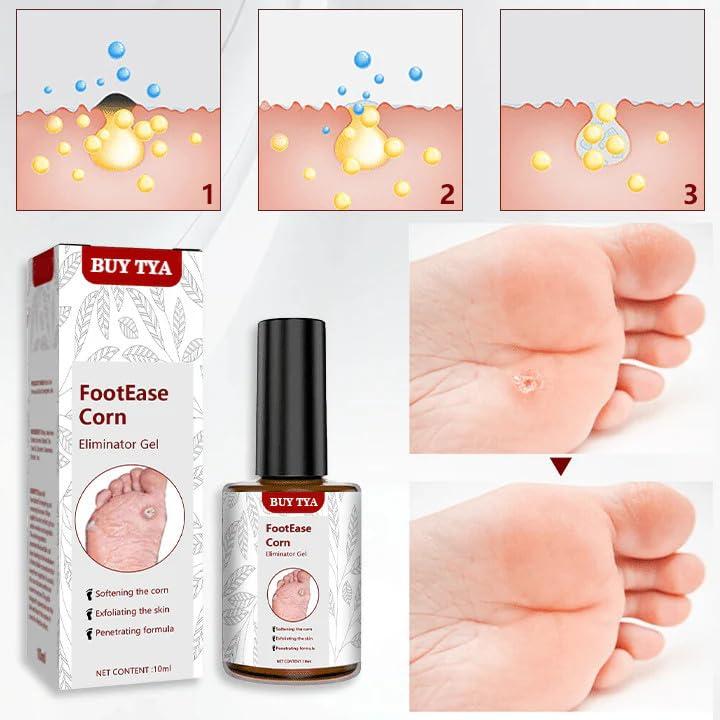 Generic Corn Ease Foot Eliminator Gel | Fast-Acting, Pain-Free Corn & Callus Remover | Gentle Formula for Soft, Smooth Feet | Effective Corn Treatment Gel for Men & Women | 30ml