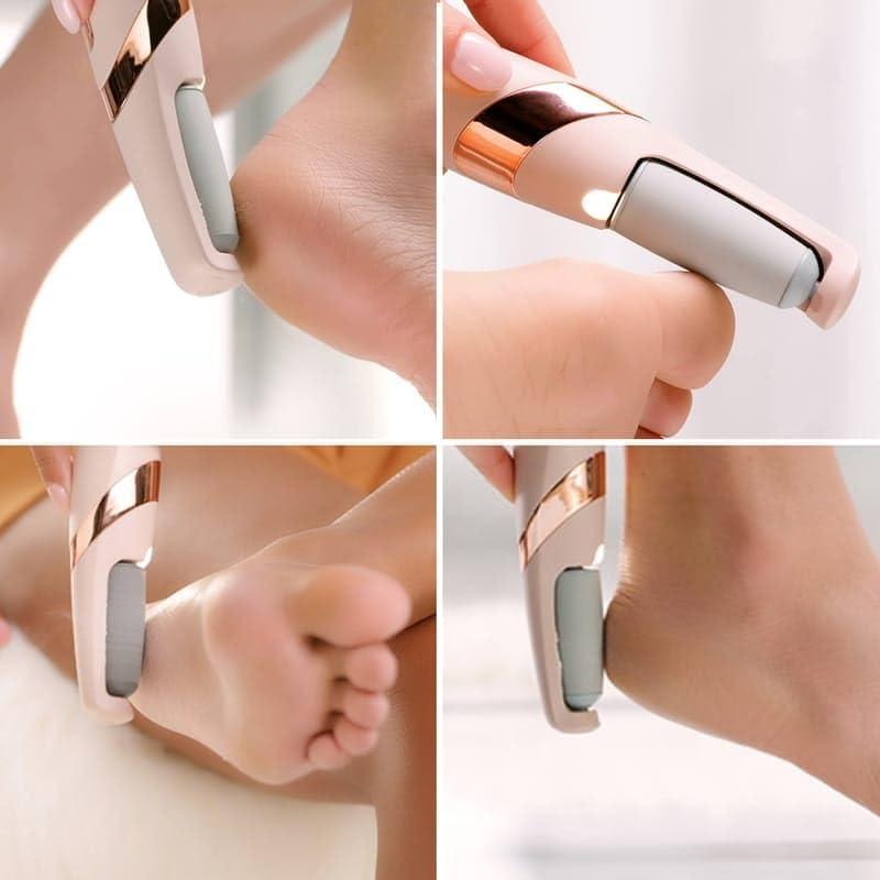 REMICH REMICH Rechargeable Flawless Pedicure Tool - Callus & Dead Skin Remover - Feet Care for Cracked Heels - Cordless Pedi Finishing Touch with 2 Roller Heads & USB Cable