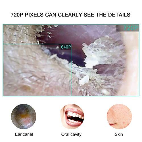 IKTU Iktu Otoscope Ear Cleaner USB Endoscope, 720P HD Visual Ear Spoon Digital Ear Camera, 3 in 1 Borescope Inspection Earwax Removal Cleaning Tool with 6 LED Lights for Android,Windows,MAC,Tablet