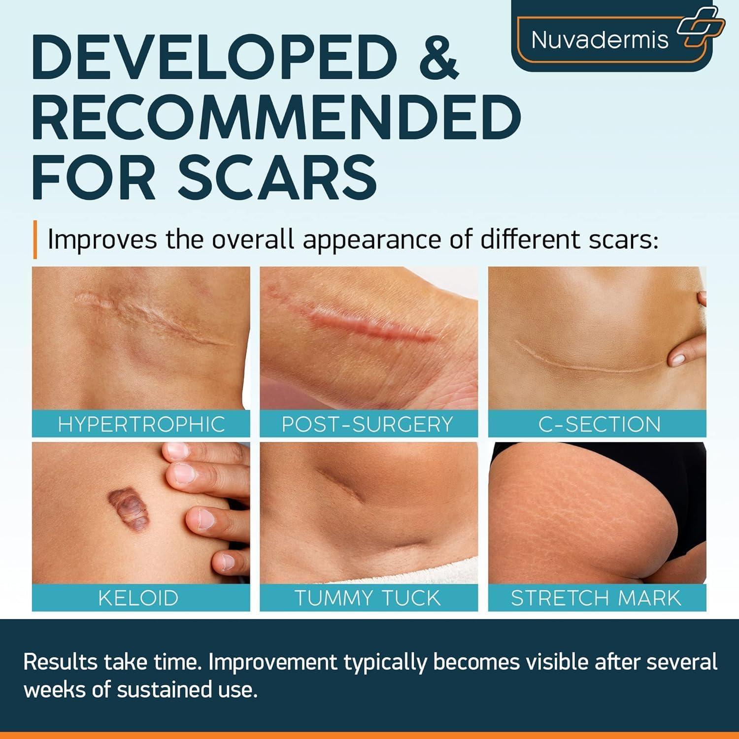 b&k NUVADERMIS Lerfot Silicone Scar Sheets Scar Removal Silicone Scar Tape 1.6X60\" For Softening And Flattening Scars, Acne, C-Section, Painless Removal, Reusable, Washable