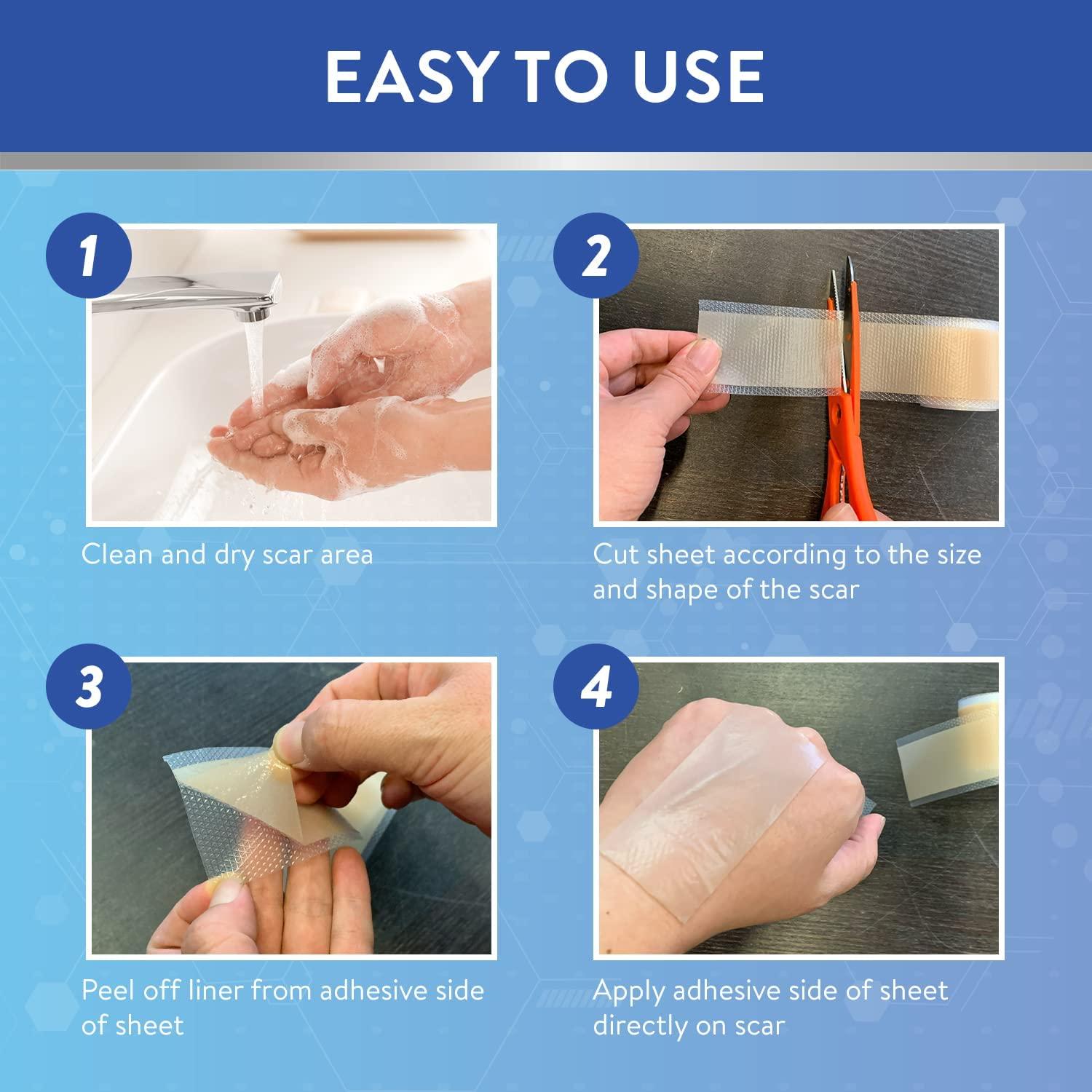 Retailio Retailio Silicone Scar Sheets Silicone Scar Tape 1.6x60" for Softening and Flattening Scars, C-Section, Keloid Surgery, Painless Removal, Reusable, Washable