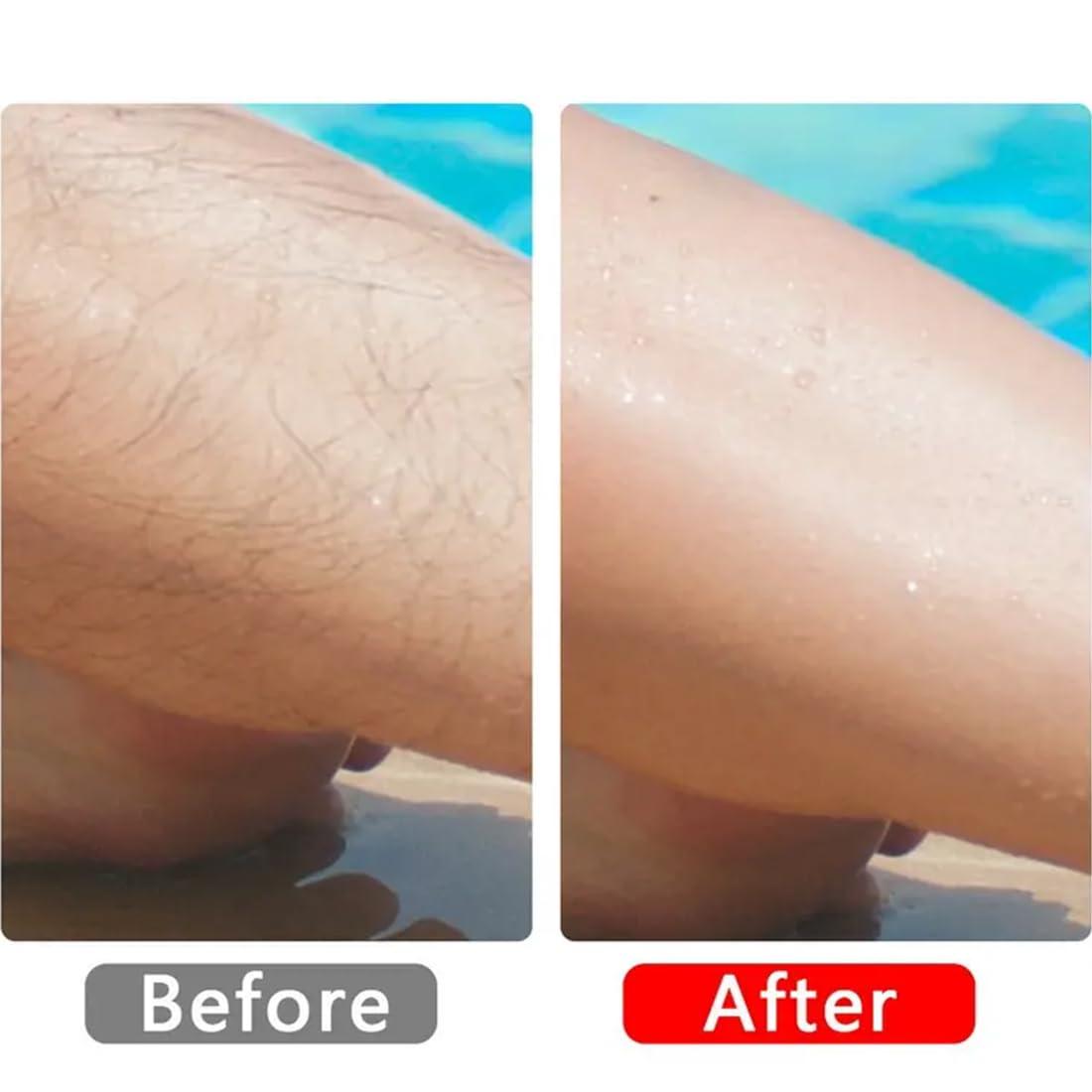 adbeni Adbeni Epilator Painless Hair Removal Exfoliation, For Women & Men, Magic Hair Remover Tool For Arms Legs Back, Washable, Smooth Silky Skin