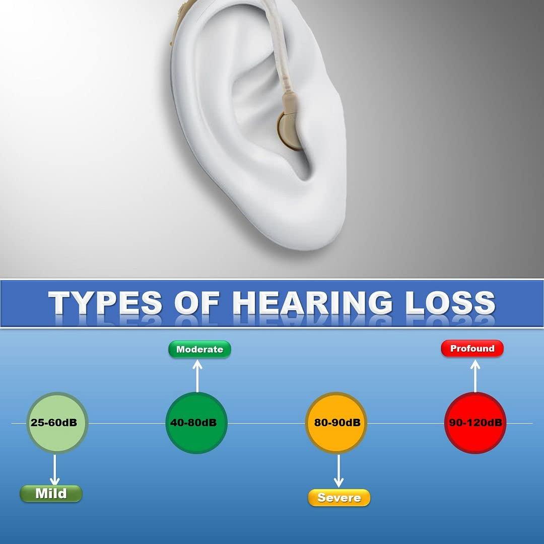 Enlinea Enlinea ENL-19 Behind-The-Ear (Bte) Hearing Aid Machine For Ear Old Age | Suitable For Mild To Moderate Hearing Loss (Pack of 2)