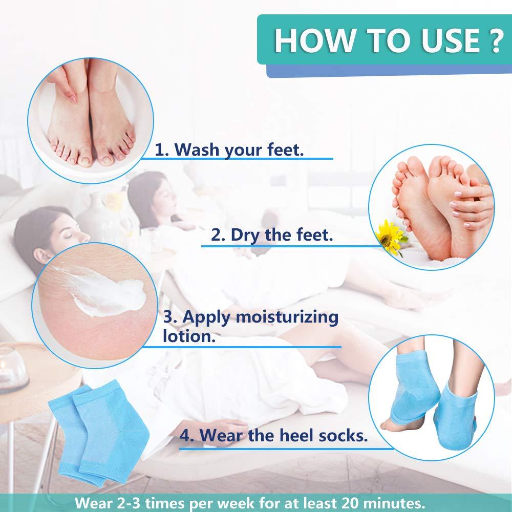 JUMPOW Moisturizing Socks, Moisturizing/Gel Heel Socks for Dry Cracked Heels, Open Toe Socks, Ventilate Gel Spa Socks to Heal and Treat Dry, Gel Lining Infused with Vitamins