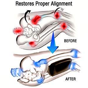 PumPum PUM PUM Orthopaedic Knee Pillow for Sciatica Relief, Back Pain, Leg Pain, Pregnancy, Hip and Joint Pain - Memory Foam Knee (Leg Pillow),Black