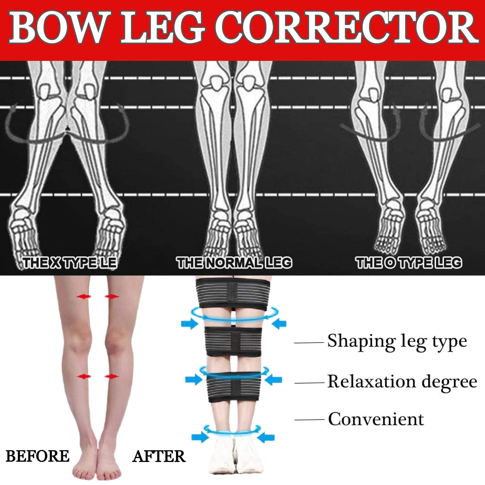 Lexotho Lexotho bow leg correction belt for men o/x type women leg corrector o/x type leg correction support strap brace bandage Correction Brace Belt (Large)