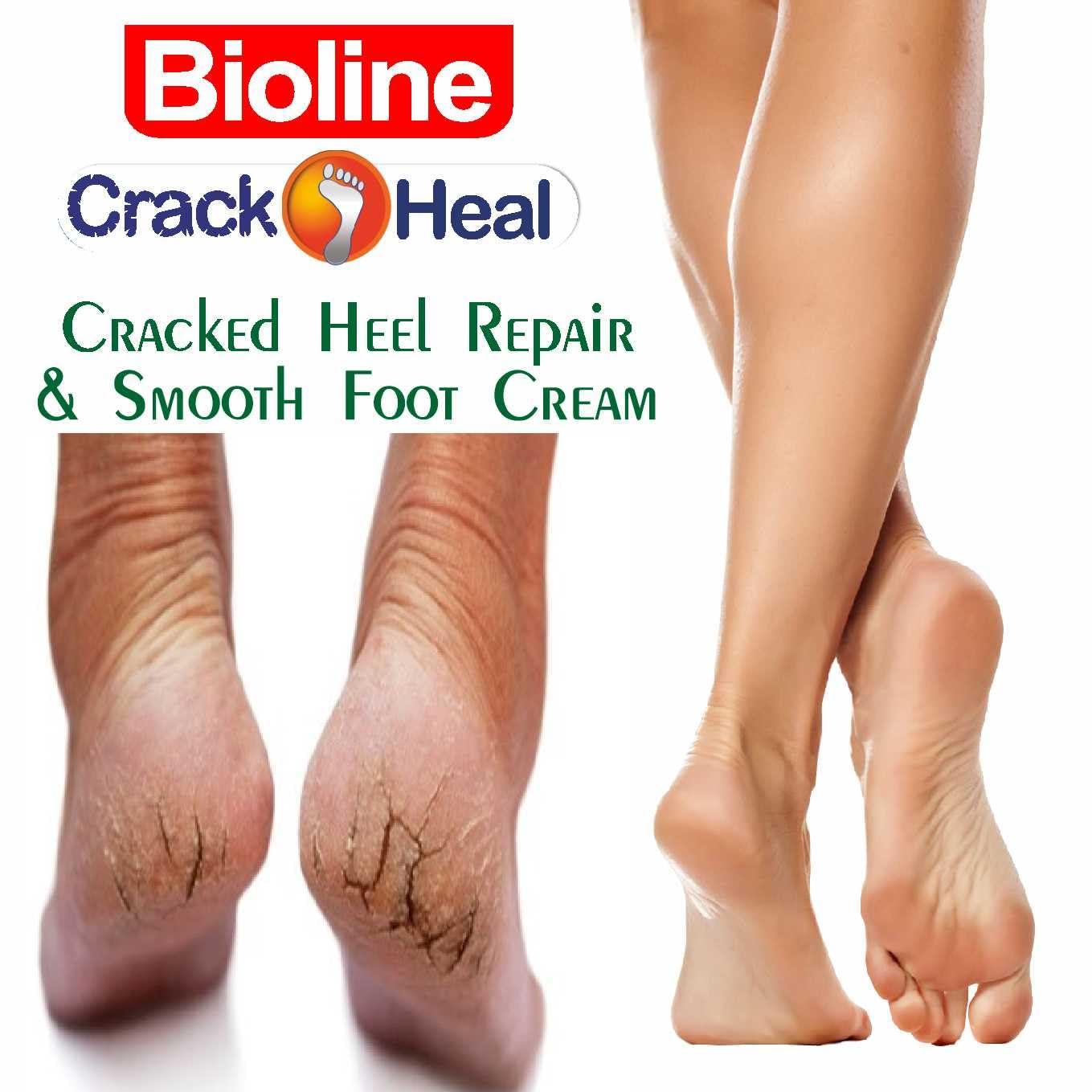 BIOLINE BIOLINE Crack Heal Foot Cream For Dry Skin & Cracked Heels - 50 g Each (Pack of 6)