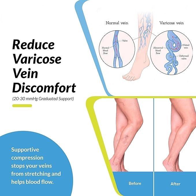 ACUWORLD Acuworld Compression Stockings for Varicose Veins | Compression Socks for Women & Men | Varicose Vein Stockings | vericose socks for women | Knee Length (Pair of 1)