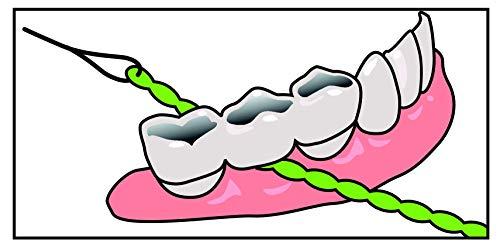 iDontix Idontix X-Floss 30 Strands Easy Bridge And Implant Floss by Idontix