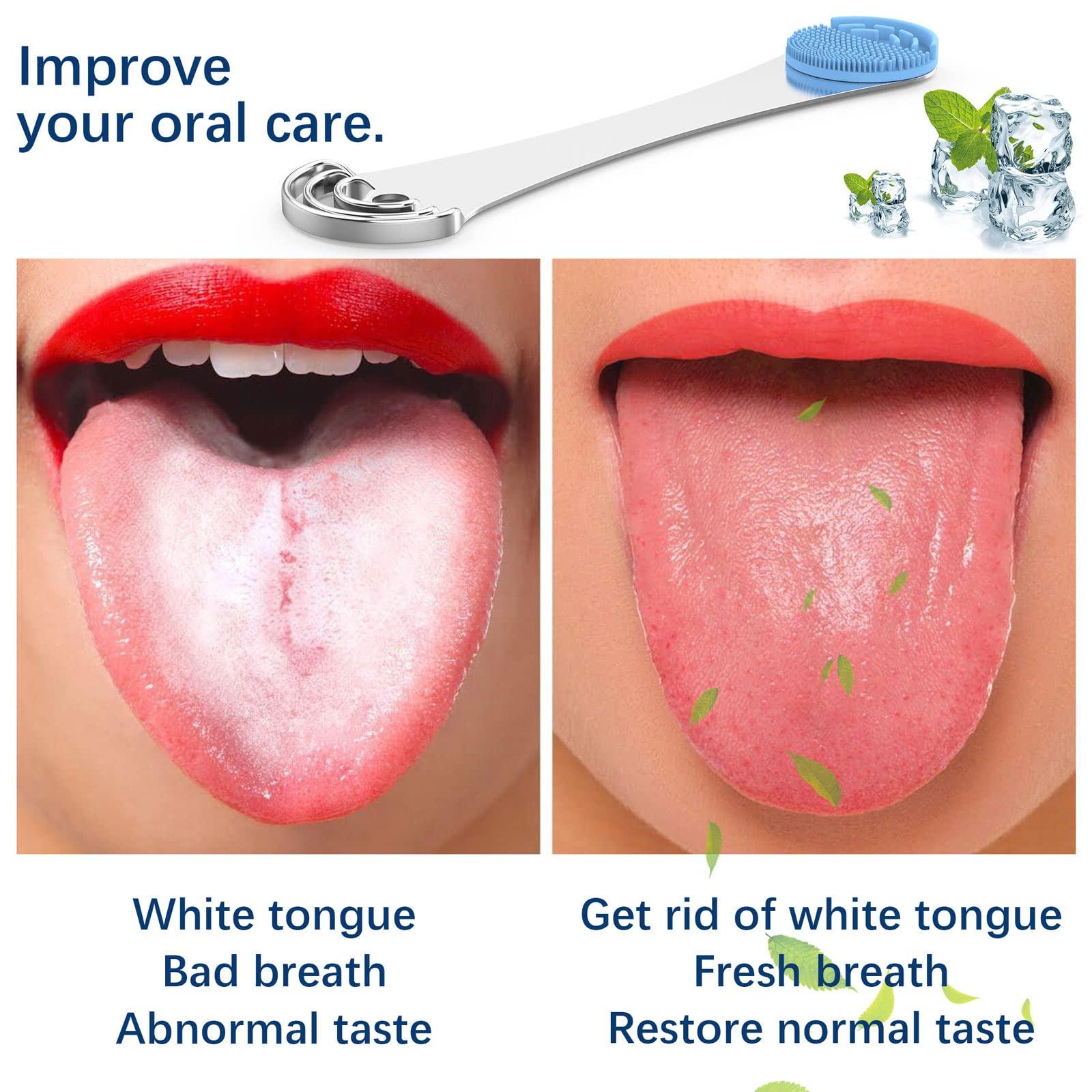 Moosec Tongue Scraper Cleaner for Reducing Bad Breath, Stainless Steel Tounge Cleaner with 2 Replaceable Tongue Brush