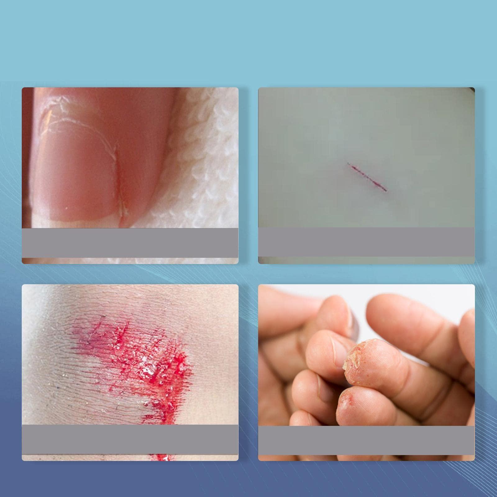 T.O.G. T.O.G. Liquid Band-Aid 10ml Rapid Film-Forming Dressing Clear for First Aid Kit